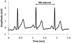 thumbnail_rmssd_graph_203f24b6_2_43fb3416d1.png